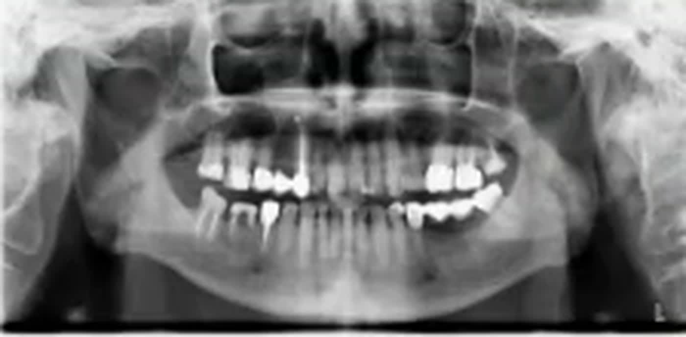 Pantomogram 2
