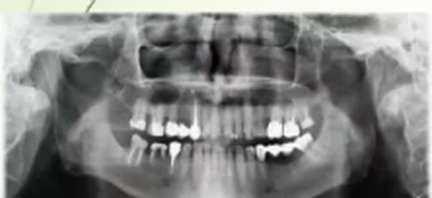 Pantomogram 3