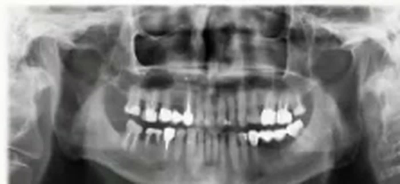 Pantomogram 4